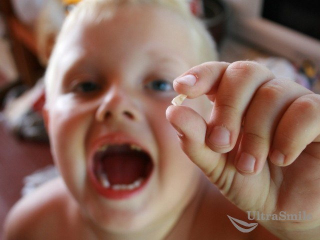 8 актуальных рекомендаций после удаления зуба у ребенка