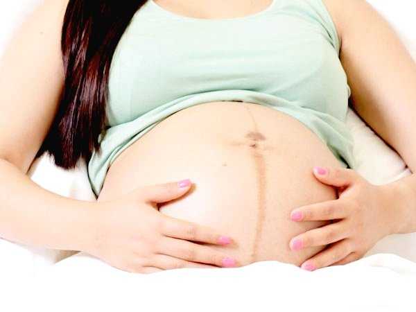 Полоса на животе у беременных когда появляется и почему